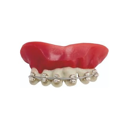 DENTIER APPAREIL DENTAIRE