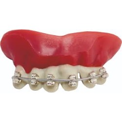 DENTIER APPAREIL DENTAIRE