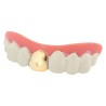 DENTIER AVEC 1 DENT EN OR 